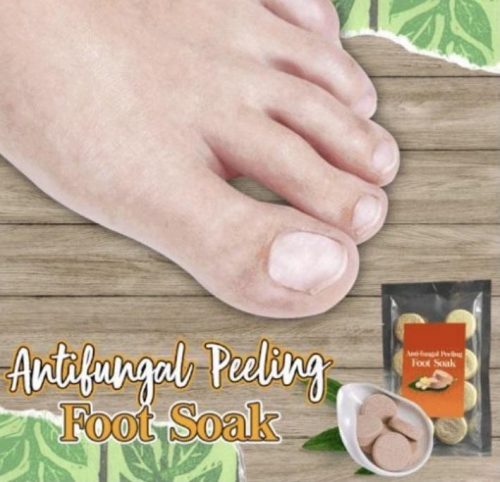 Anti-fungal Peeling Foot Soak