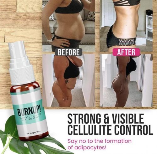 BurnUp! Ultimate Cellulite Heating Spray